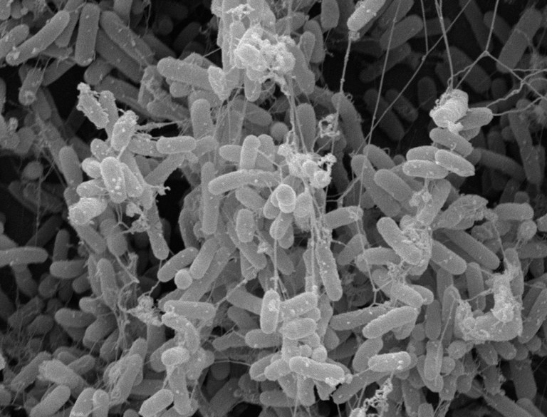 An electron microscopy image shows an E. coli biofilm.