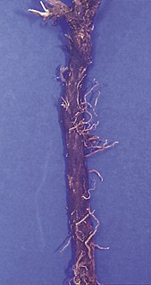 Roots of spotted knapweed