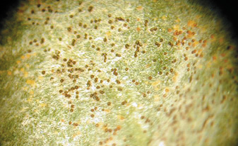 Ascomata on sugar beef leaf through hand lens